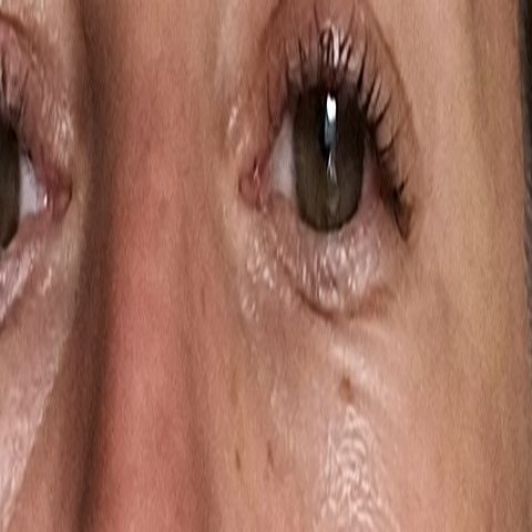 Dark Circles zoom