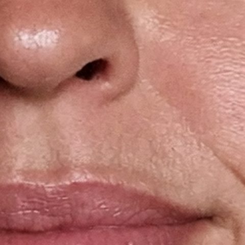 Pores