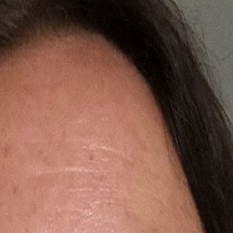 Spots